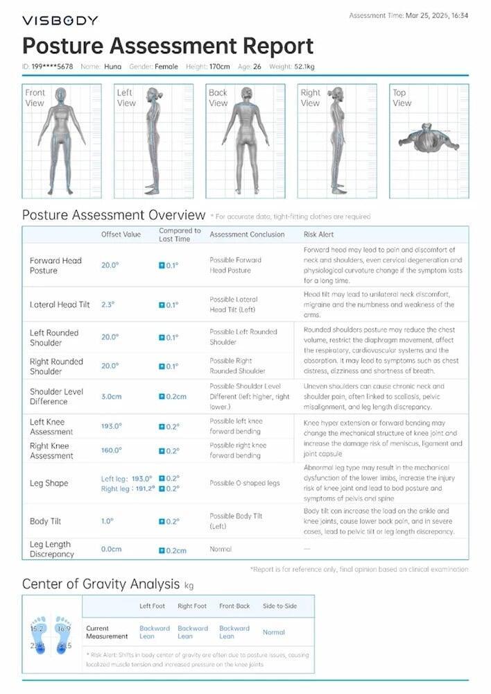 Posture evaluation showing head tilt and pelvic alignment