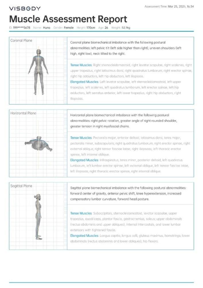Shoulder mobility assessment with range of motion indicators